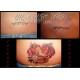 Tatto Clinic Dr. Mortiis 